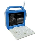 Lätt bär bärbar B / W bärbar dator ultraljudsskanner