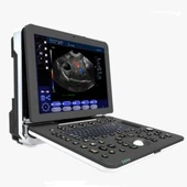 Laptop Ultraljud Diagnostiskt System