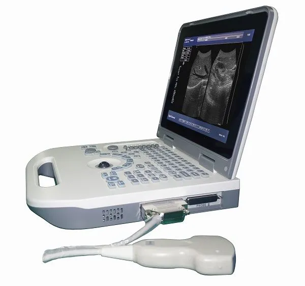 Fullständiga digitala ultraljudsskanningsmaskiner