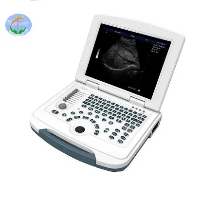 Black And White Laptop Ultrasound Scanner