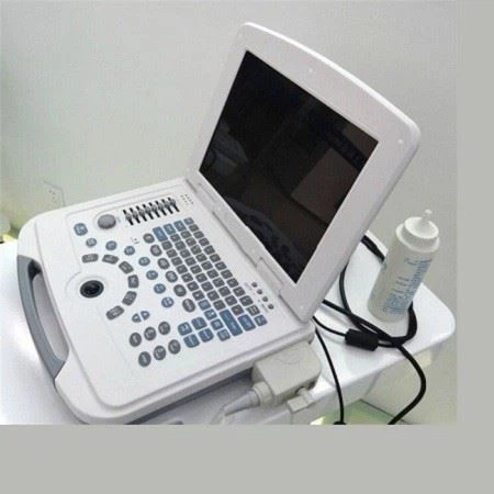 Black And White Laptop Ultrasound Scanner