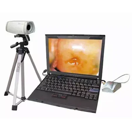 Gynecology Examination Optical Colposcopy